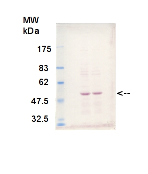 western blot detection using anti-VTC2 antibodies